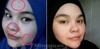 DIY Toner Air Mawar RM5, Kikis Habis Jeragat Degil