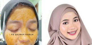 10 Minit Relakan Muka Kuning, Kesannya Jerawat Dan Pori-pori Pun Mengecut