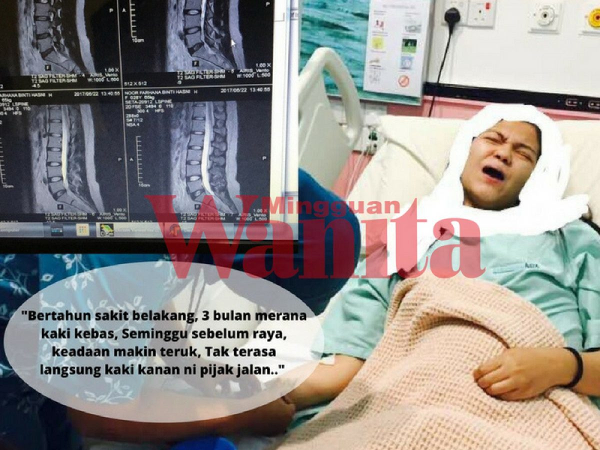 Bertahun Sakit Belakang Merana Kaki Kebas Gadis Ini Kongsi Pengalaman Kena Slipped Disc Mingguan Wanita